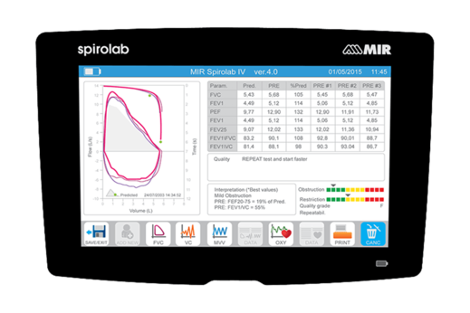 06_Spirolab_Top_View_Spirometry_Results.png