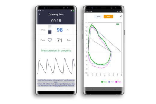 tiny_Spirobank-App-Plethysmographic-Curve-and-Spirometry-Curve.p